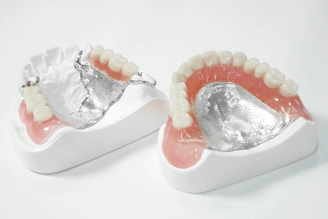 denture-metal