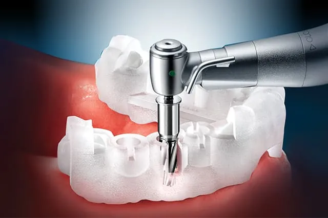 implant-premium-point1