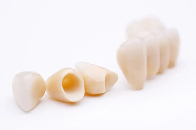 implant-premium-point3