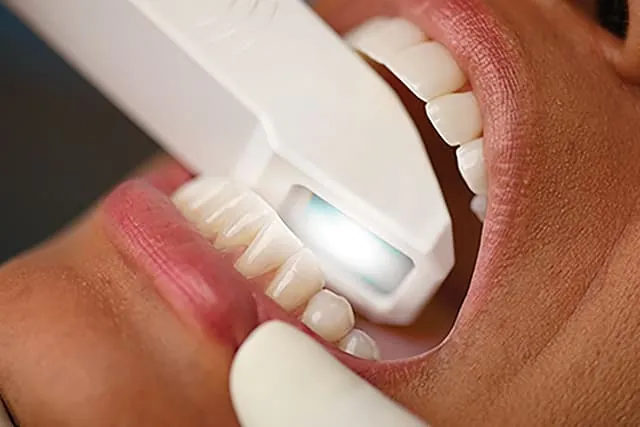 implant-premium-scanner1