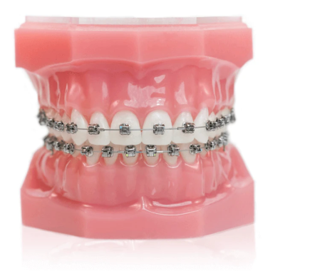 orth-seijin-bracket-metal