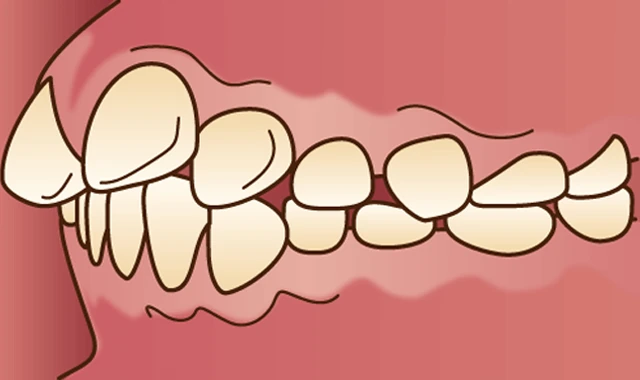 orth-seijin-mal-jyogaku-zentotsu