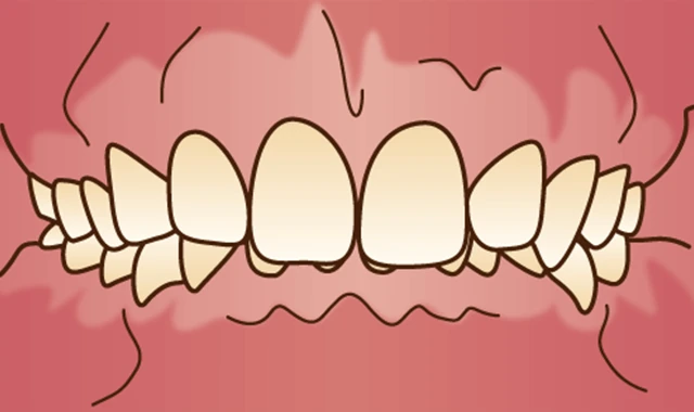 orth-seijin-mal-kagai-kougou