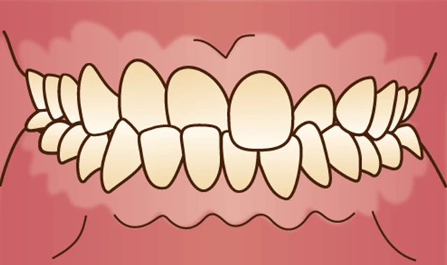 orth-seijin-mal-kousa-kougou
