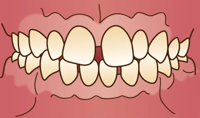 orth-seijin-mal-seityu-rikan