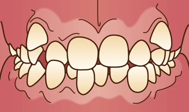 orth-seijin-mal-sousei