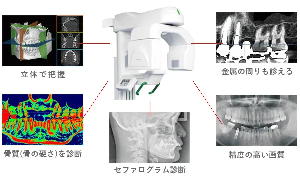 top-CTscan